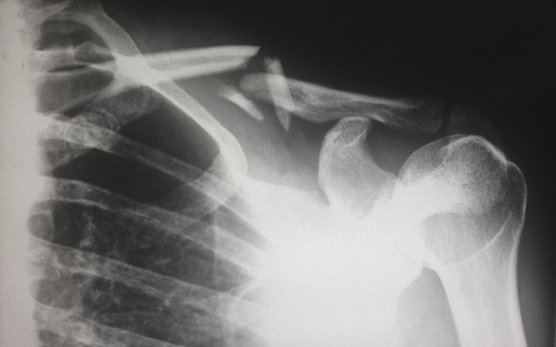 8. Increased Risk of Fractures (image credits: unsplash)