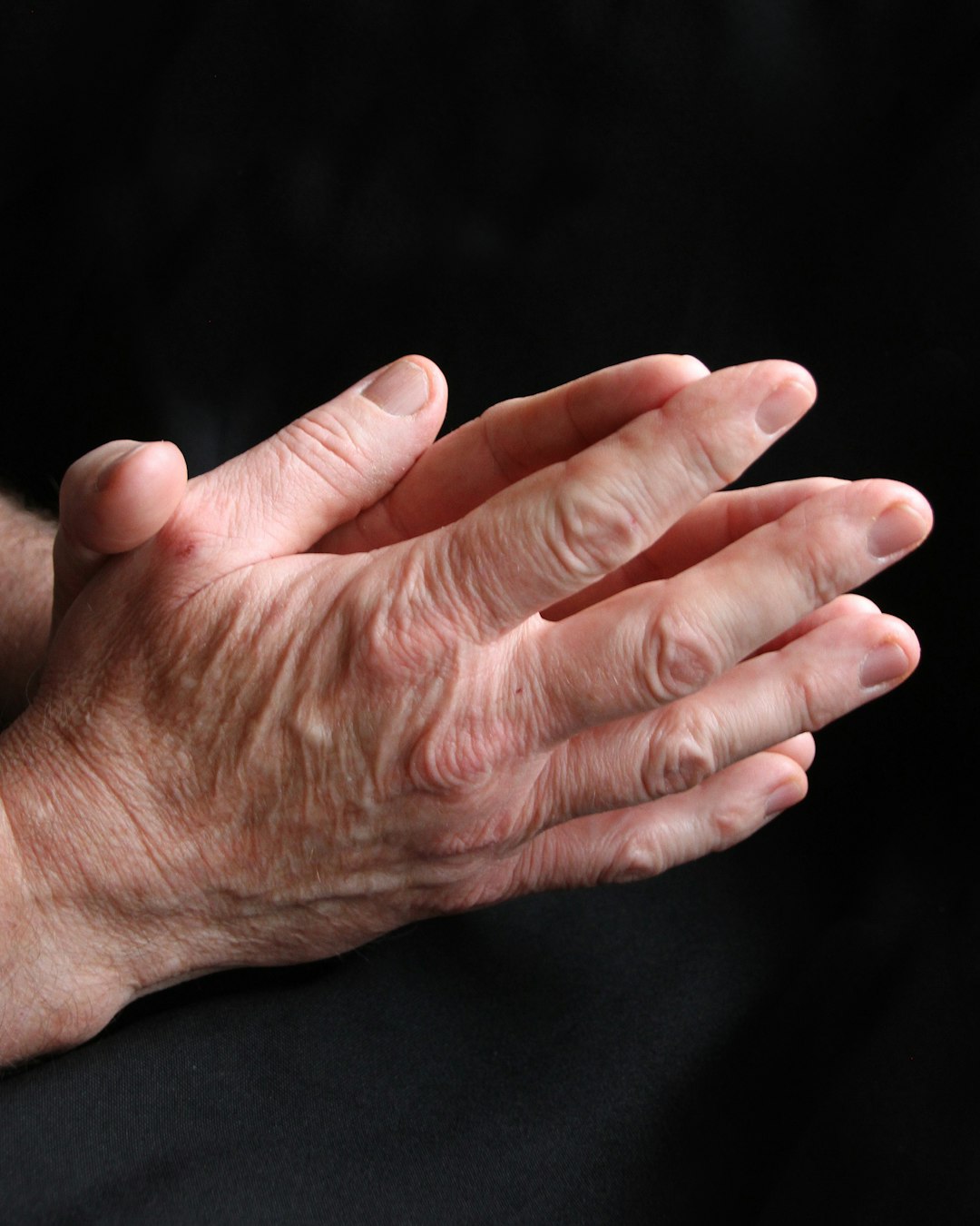 Sodium and Osteoporosis (image credits: unsplash)