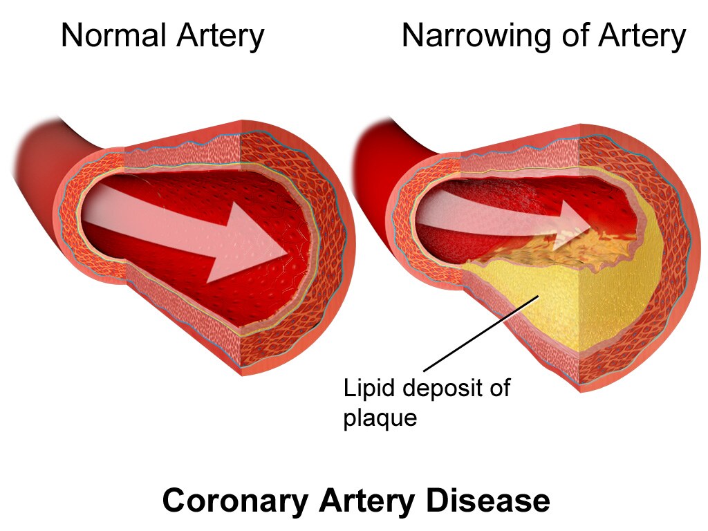 Your Body's Response: Inflammation and Immune Confusion (image credits: flickr)