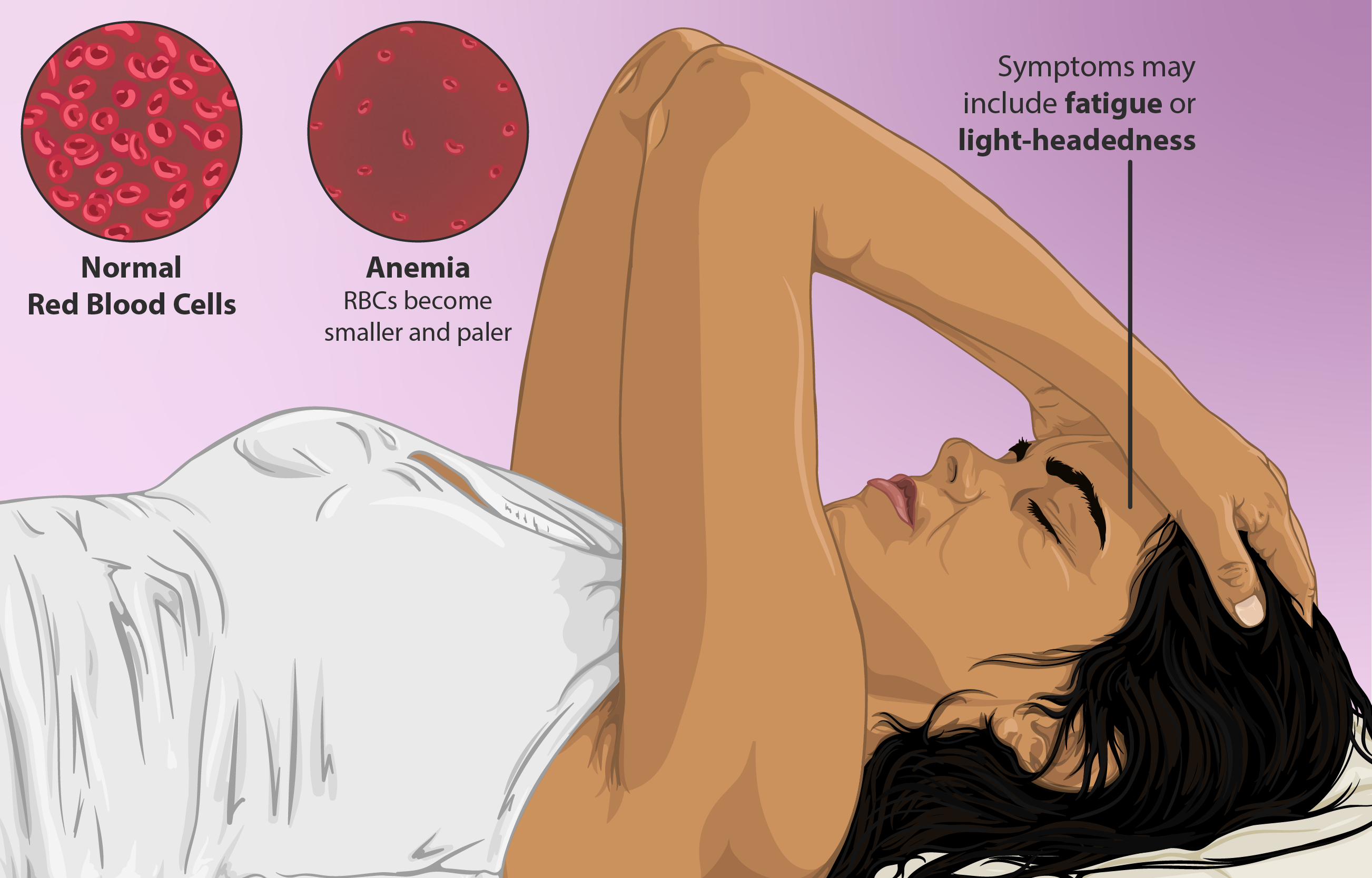 Fatigue and Weakness (image credits: wikimedia)