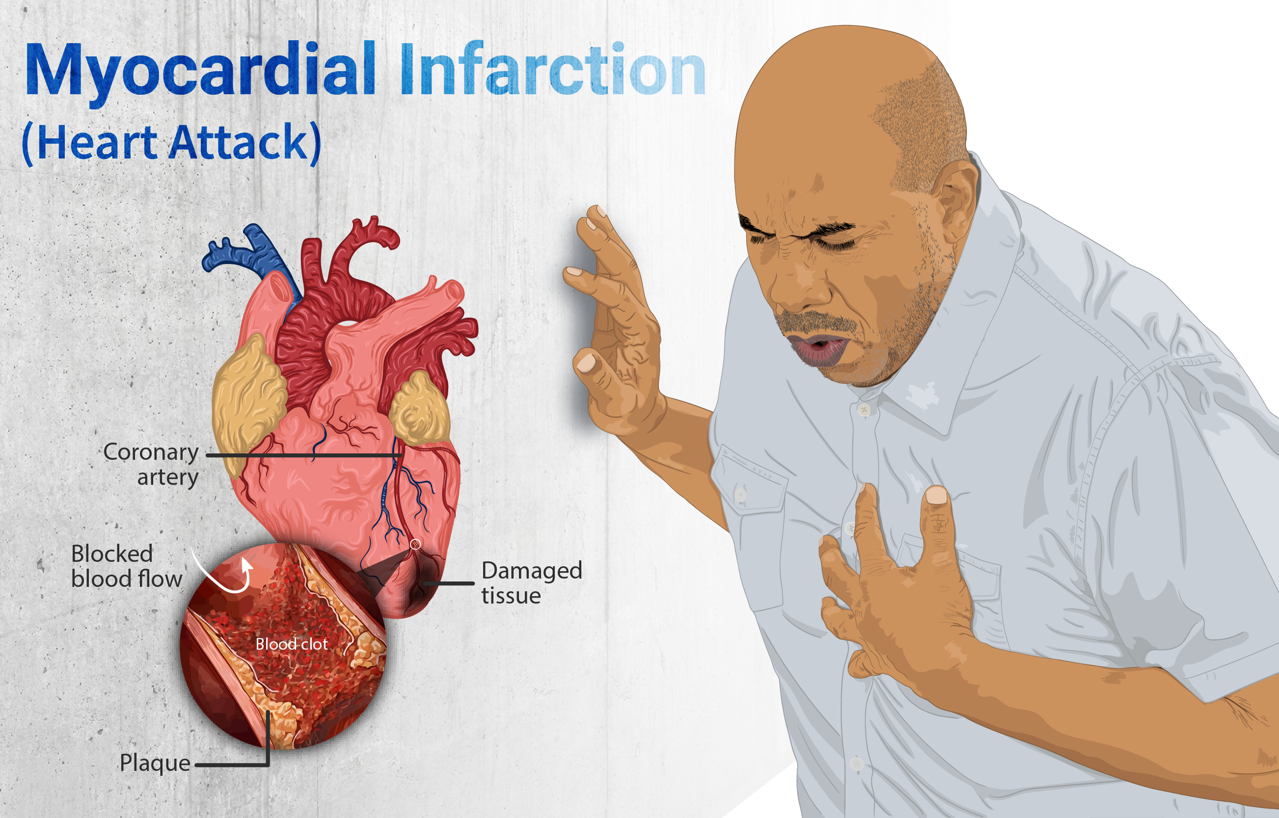 Your Heart Takes a Direct Hit (image credits: wikimedia)