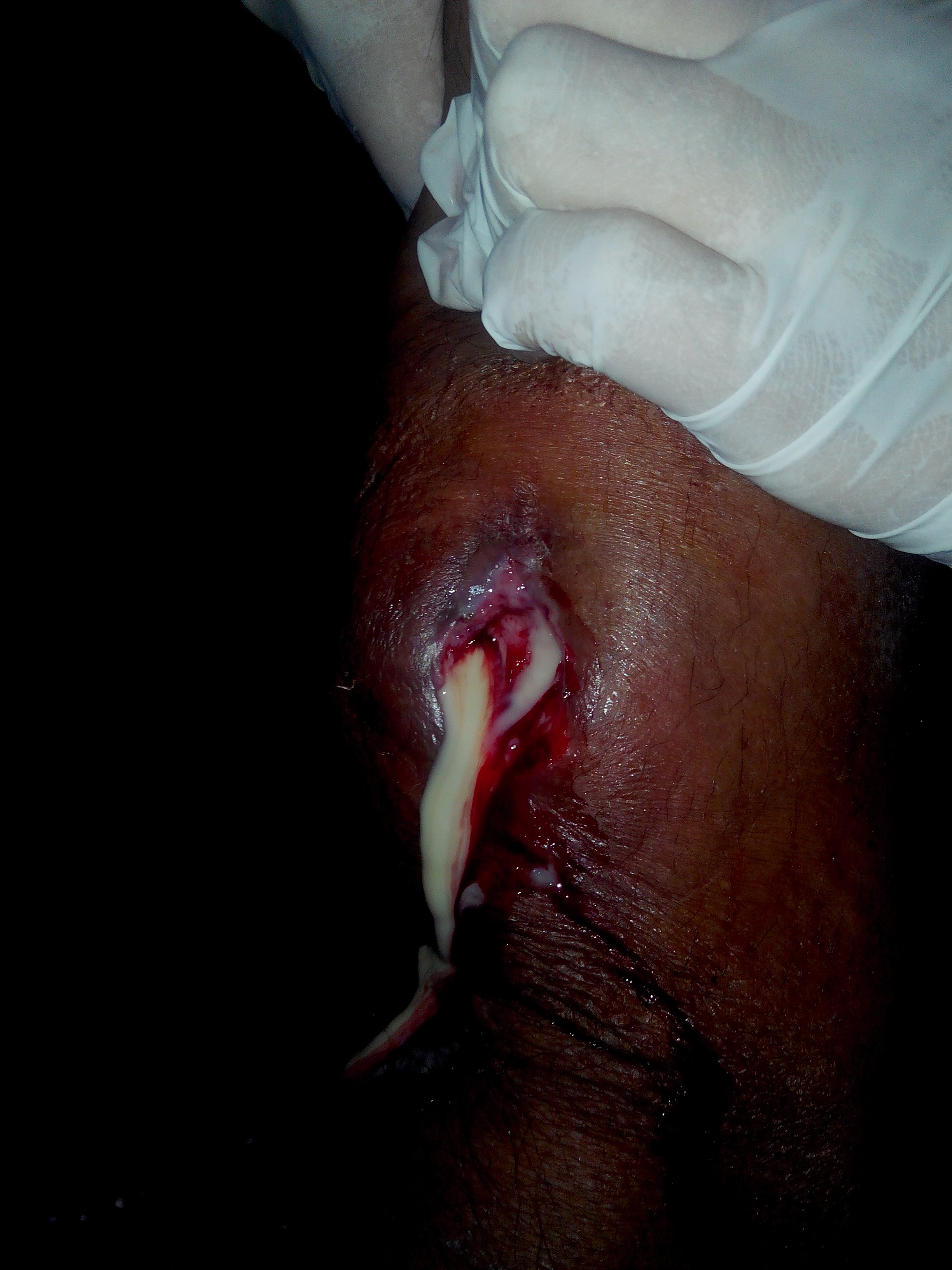 Slow Wound Healing: Zinc and Vitamin C Play a Vital Role (image credits: wikimedia)