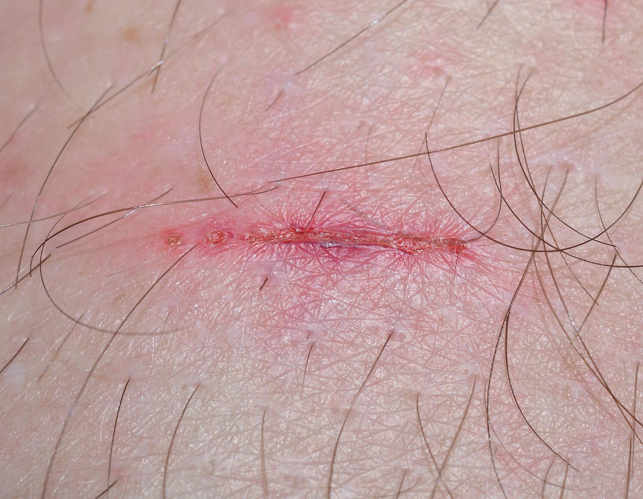 4. Slow Wound Healing (image credits: pixabay)
