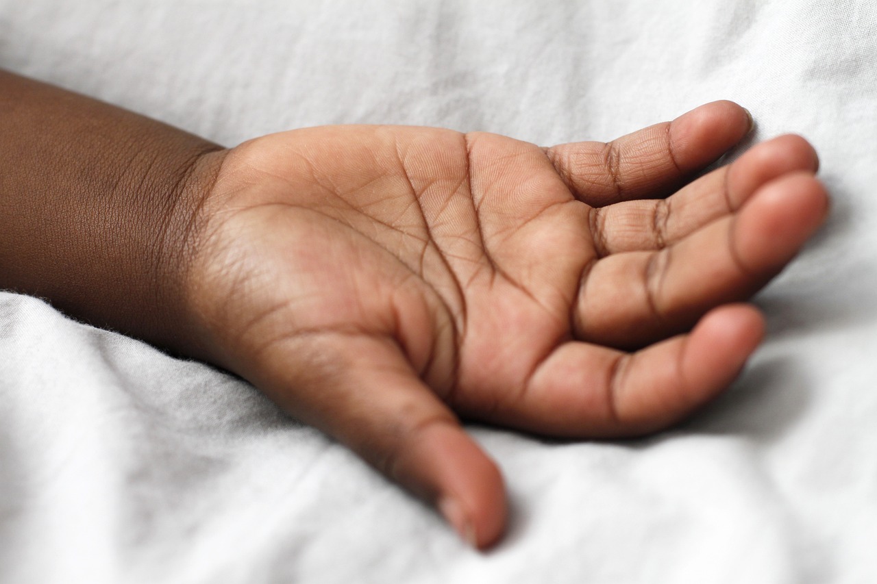 Pale or Jaundiced Skin (image credits: pixabay)