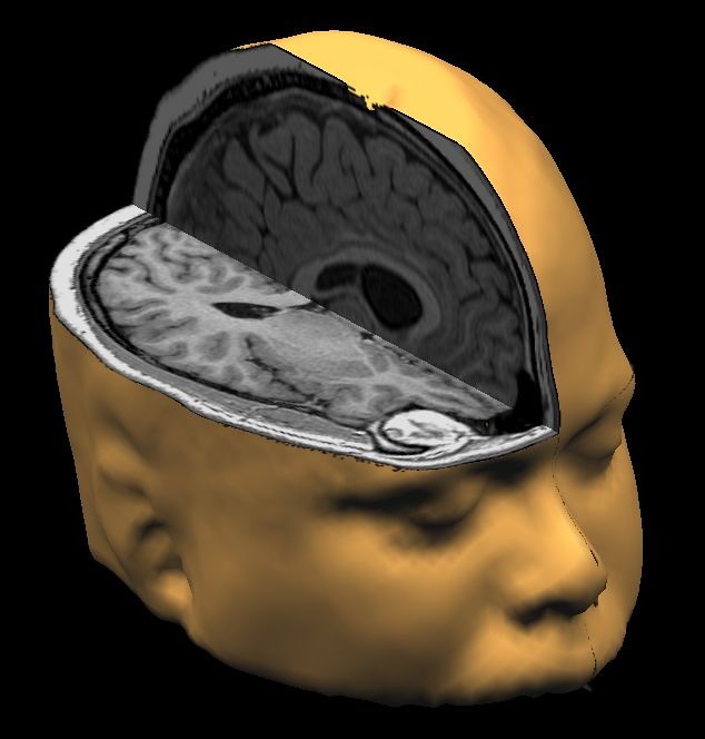Physical Brain Changes Detected (image credits: flickr)