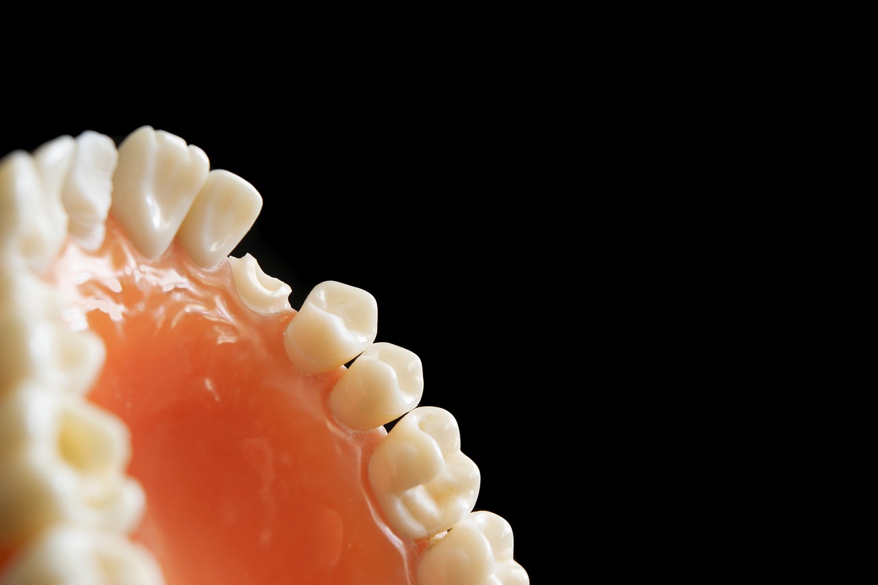 Tooth Decay & Gum Issues (image credits: pixabay)