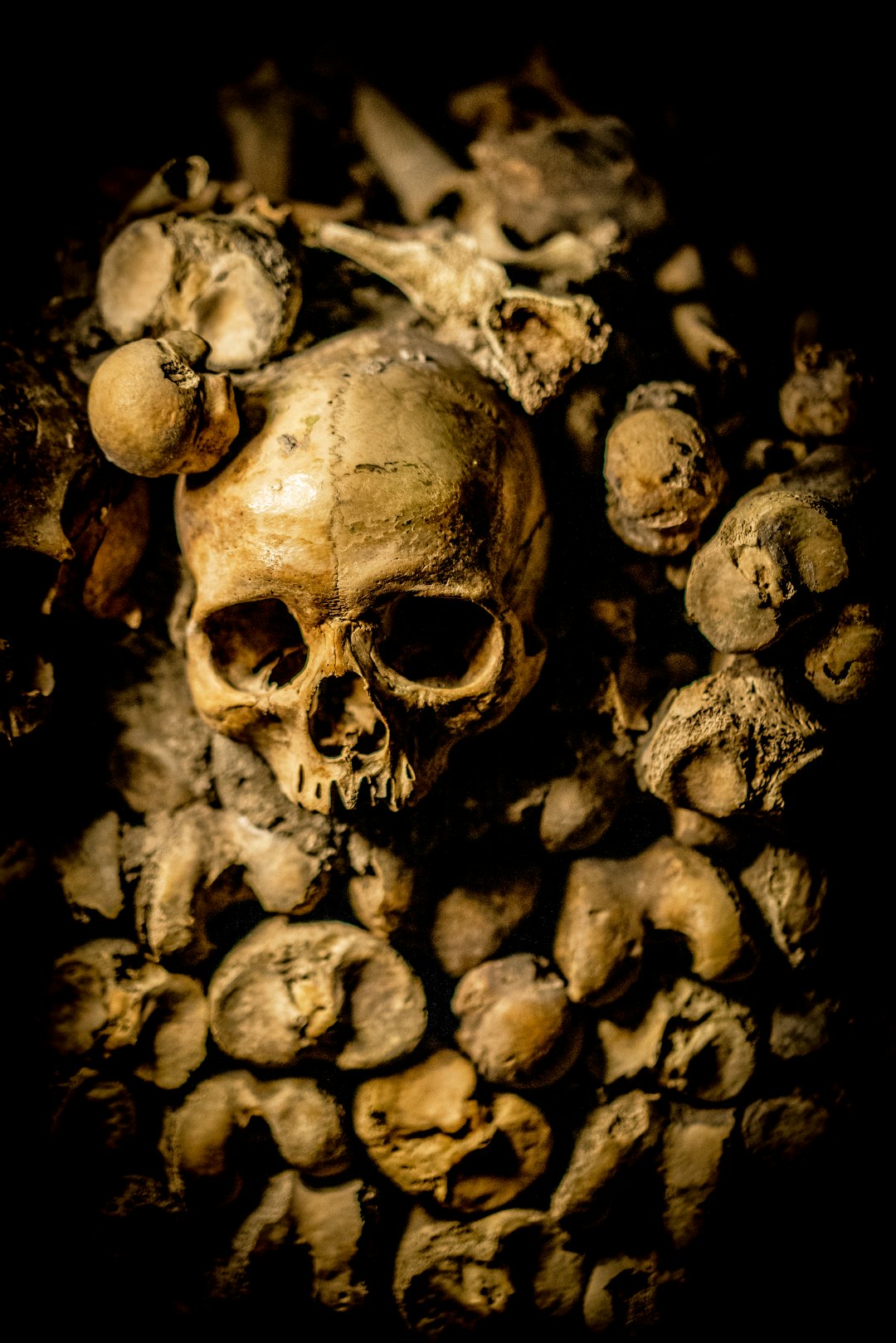 Osteoporosis Risk (image credits: unsplash)