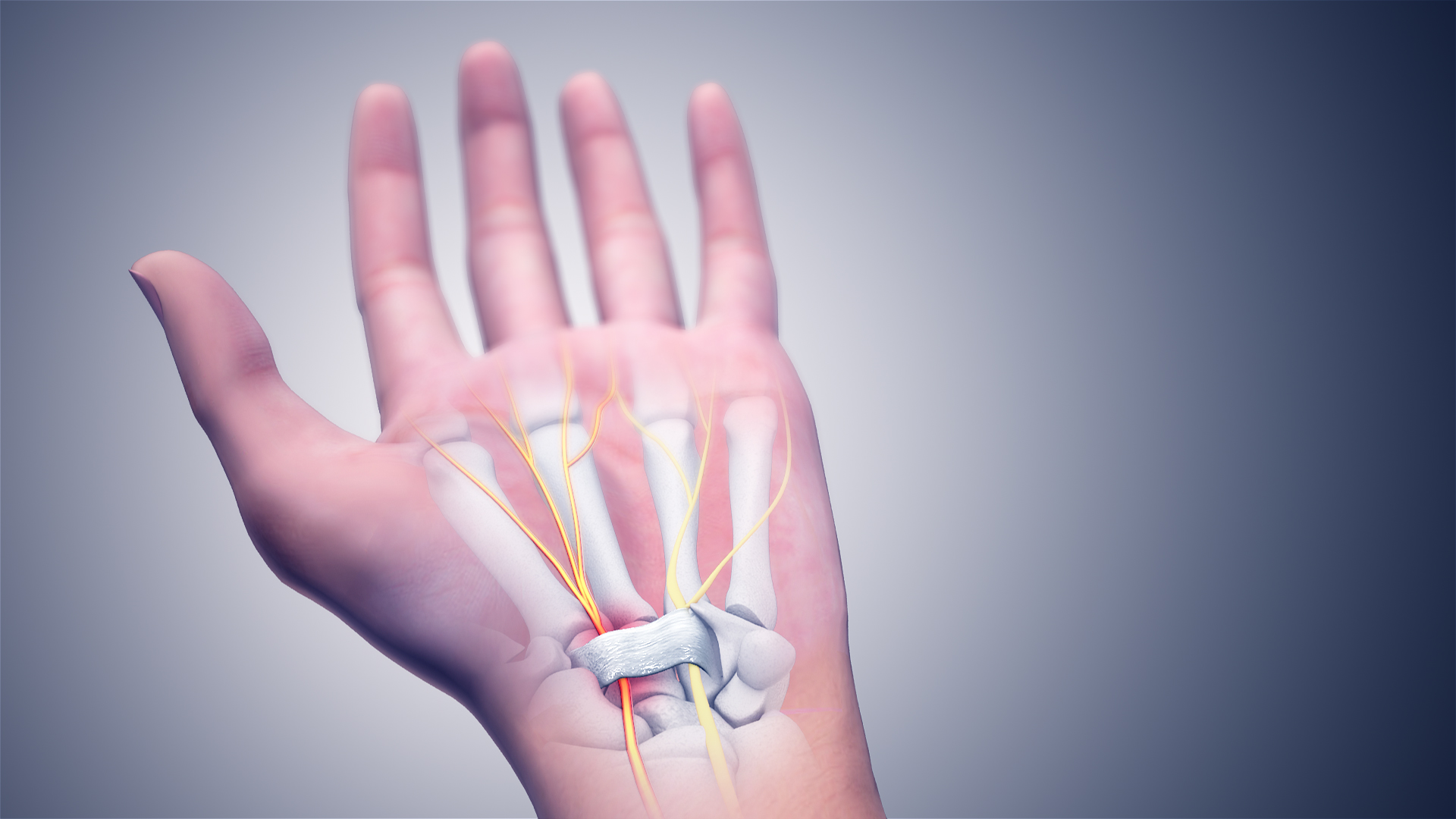 Nerve Problems (image credits: wikimedia)