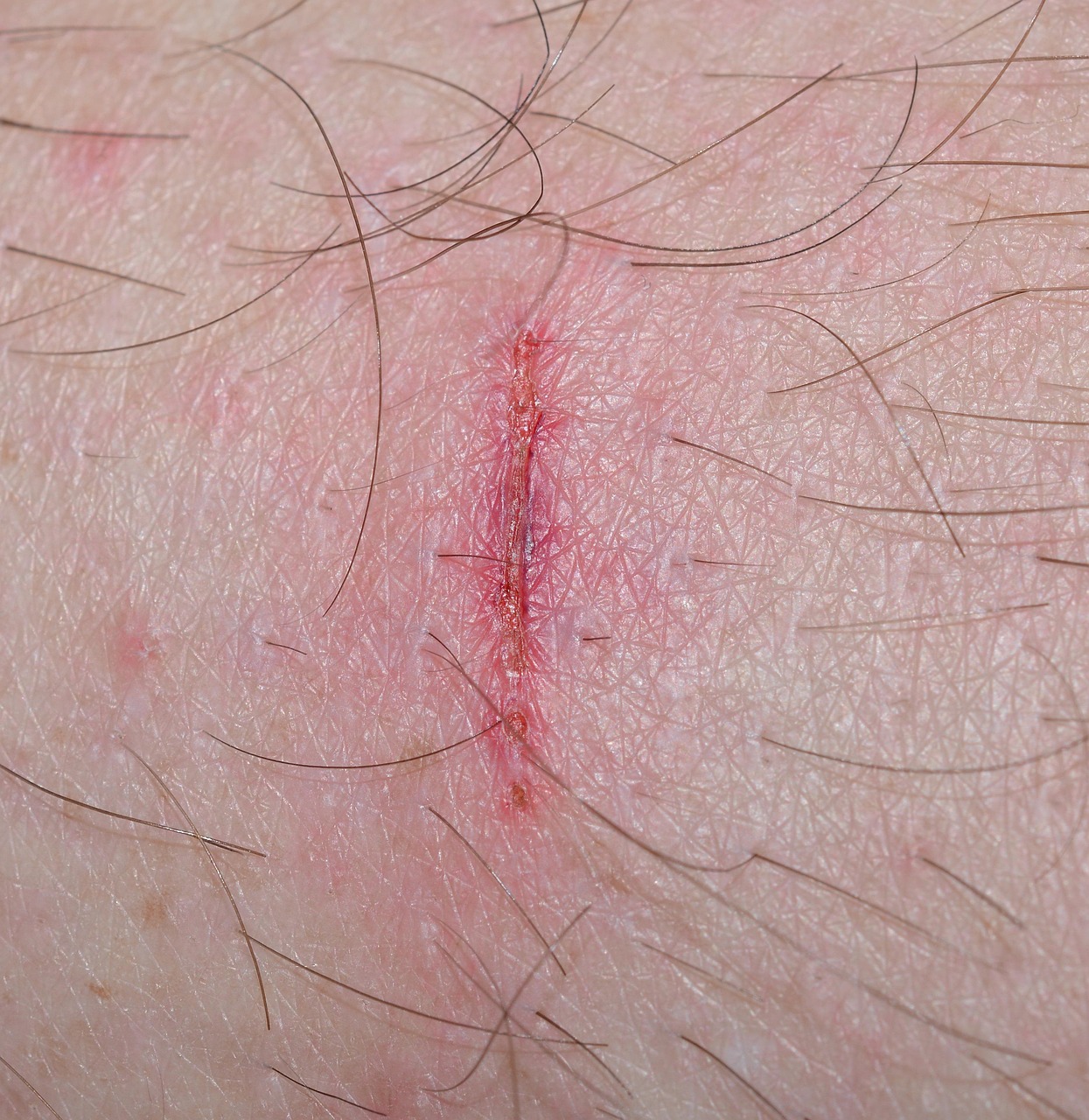 5. Slow Healing of Wounds (image credits: pixabay)