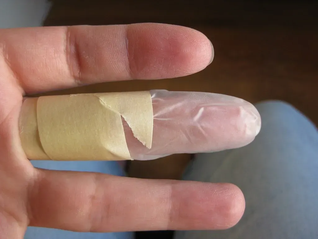 The Mandoline Slicer Sends Thousands to Emergency Rooms (Image Credits: Flickr)