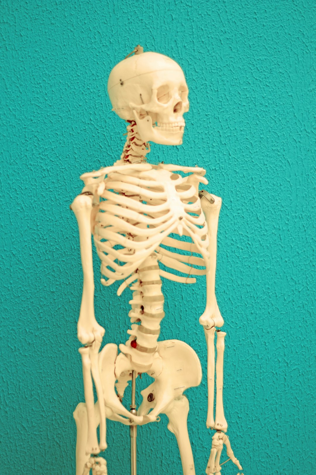 Weakened Bones and Increased Fracture Risk (image credits: unsplash)
