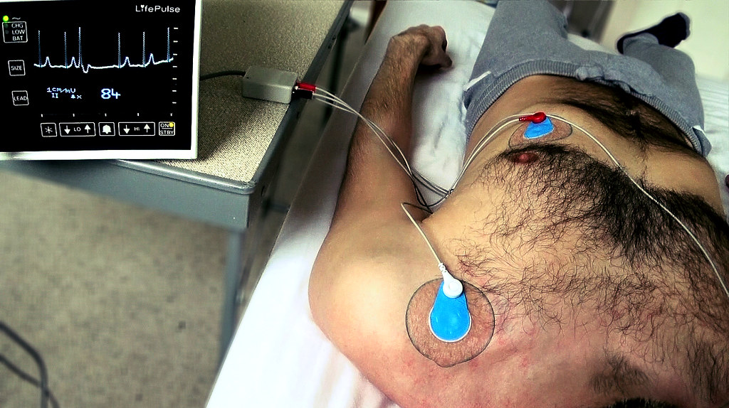 Heart Rhythm Problems That Shouldn't Be Ignored (image credits: flickr)