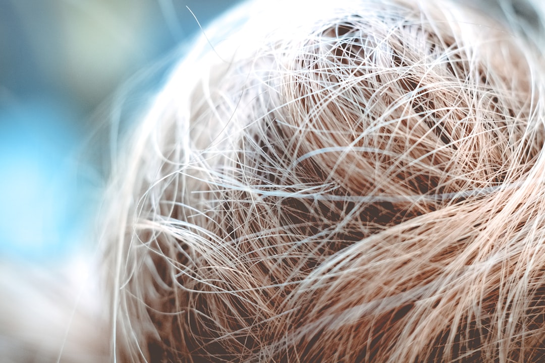2. Brittle Nails and Hair: The Hidden Signal of Biotin Deficiency (image credits: unsplash)