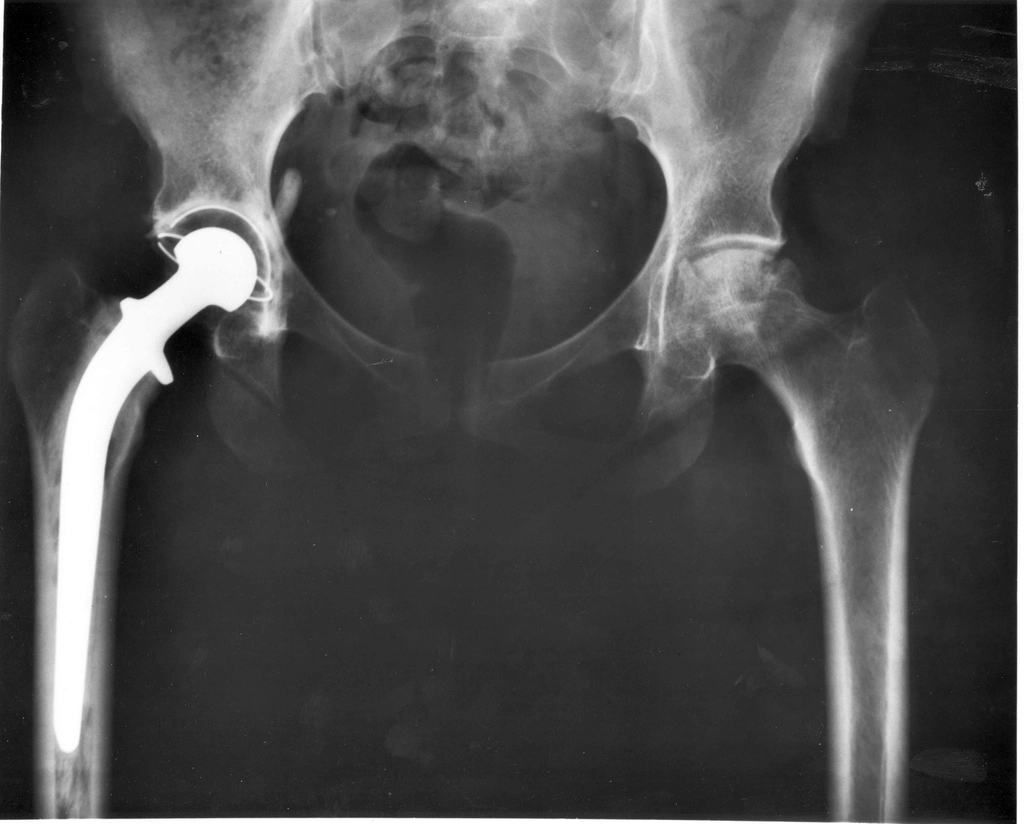 Bone Pain: An Invisible Threat (Vitamin D Deficiency) (image credits: rawpixel)