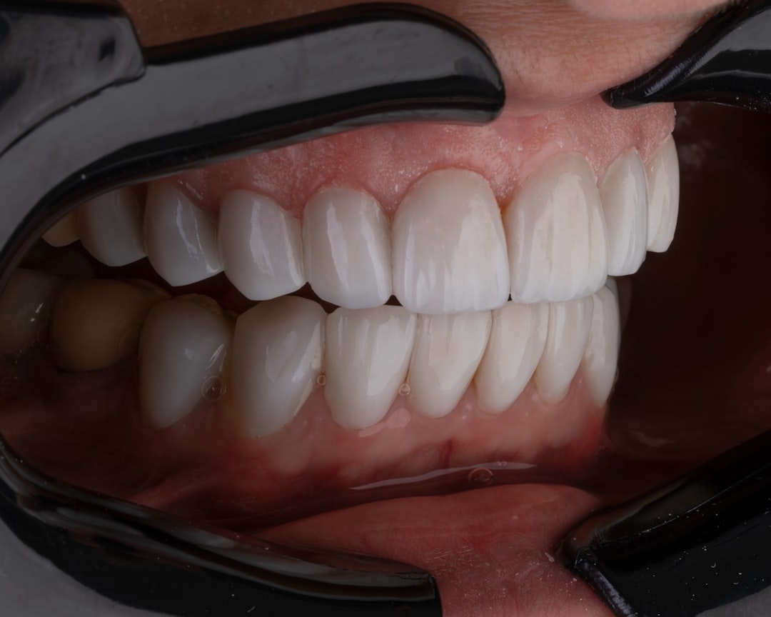 Dental Problems and Tooth Sensitivity (image credits: unsplash)