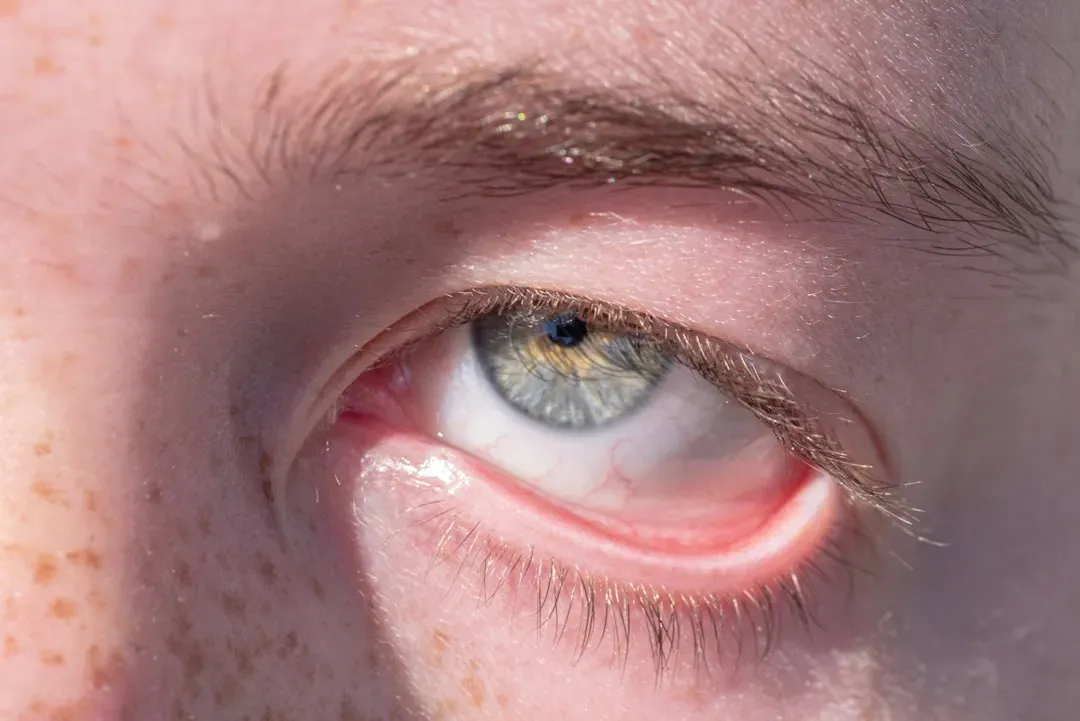1. Pale or Yellowish Skin and Inner Eyelids (Image Credits: Unsplash)