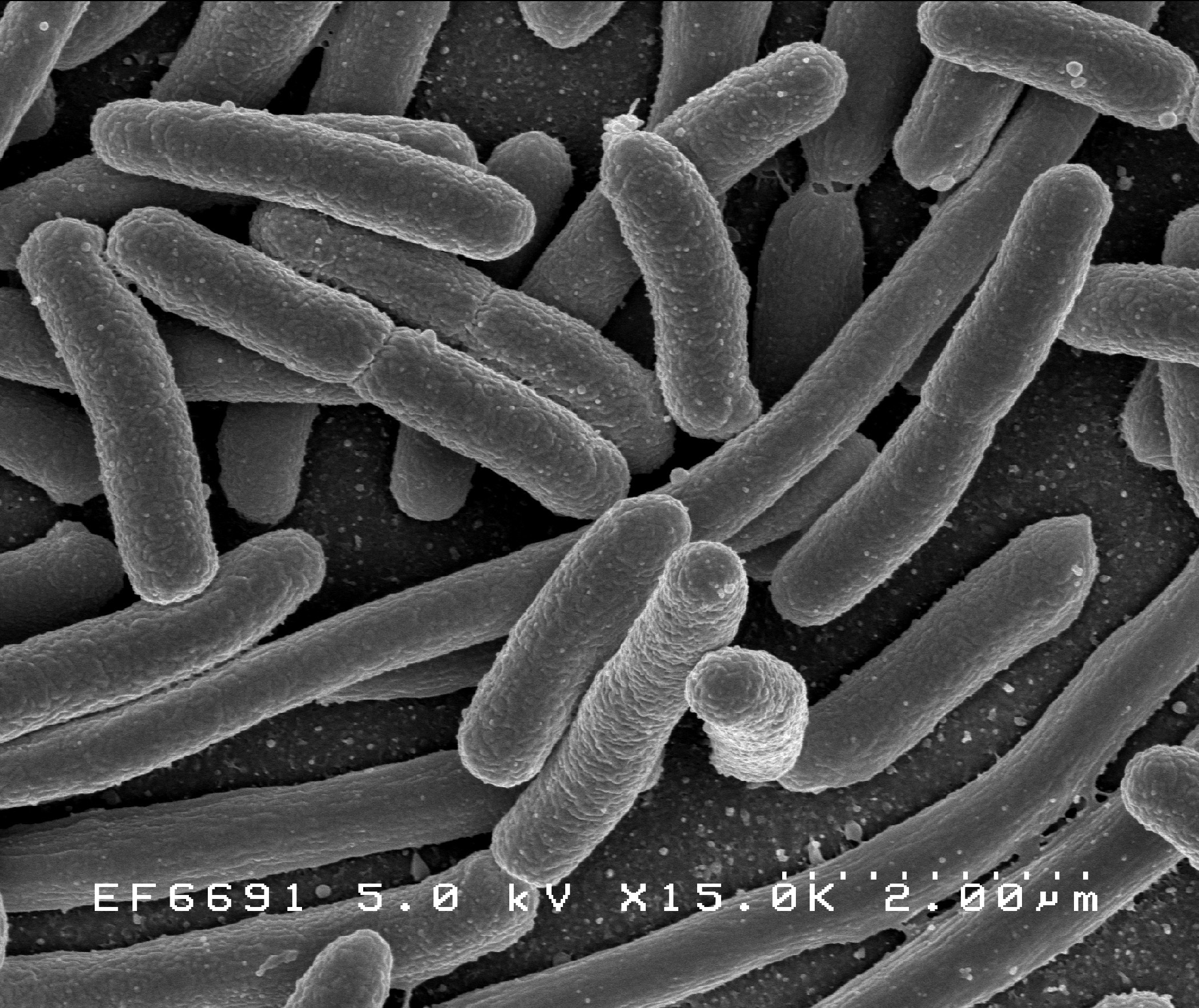 The E. Coli O157:H7 Threat (image credits: wikimedia)