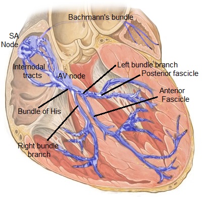 Irregular Heartbeat (image credits: wikimedia)