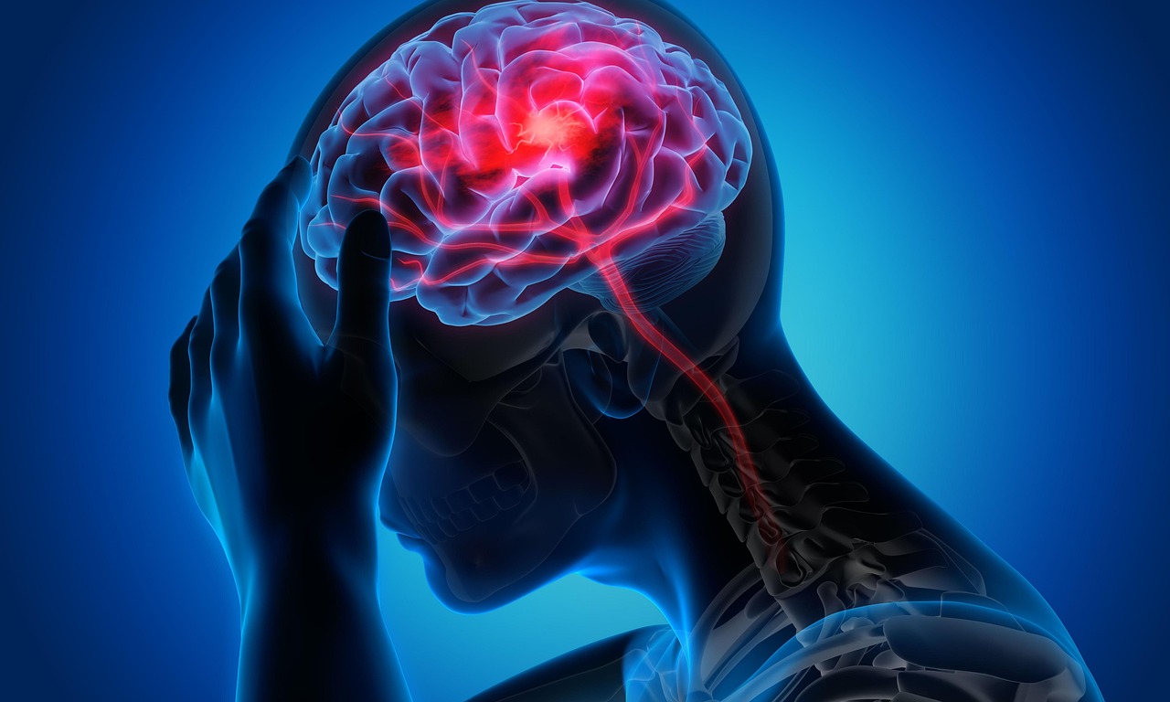Frequent Headaches and Migraines (image credits: pixabay)