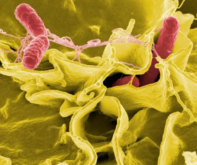 Salmonella Is a Much Bigger Problem Than You Think (Image Credits: Wikimedia)