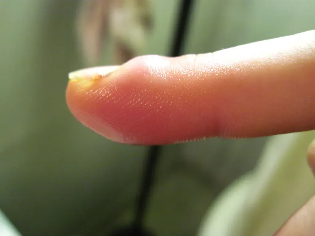 Hour 18: The Sodium Situation Gets Real (Image Credits: Flickr)