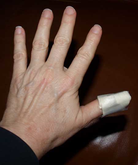 The Top Chef Contestant Who Needed Emergency Surgery (image credits: flickr)