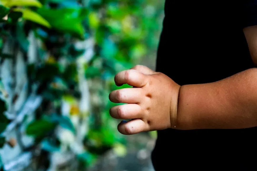 The CDC's Numbers Tell a Stark Story (Image Credits: Unsplash)