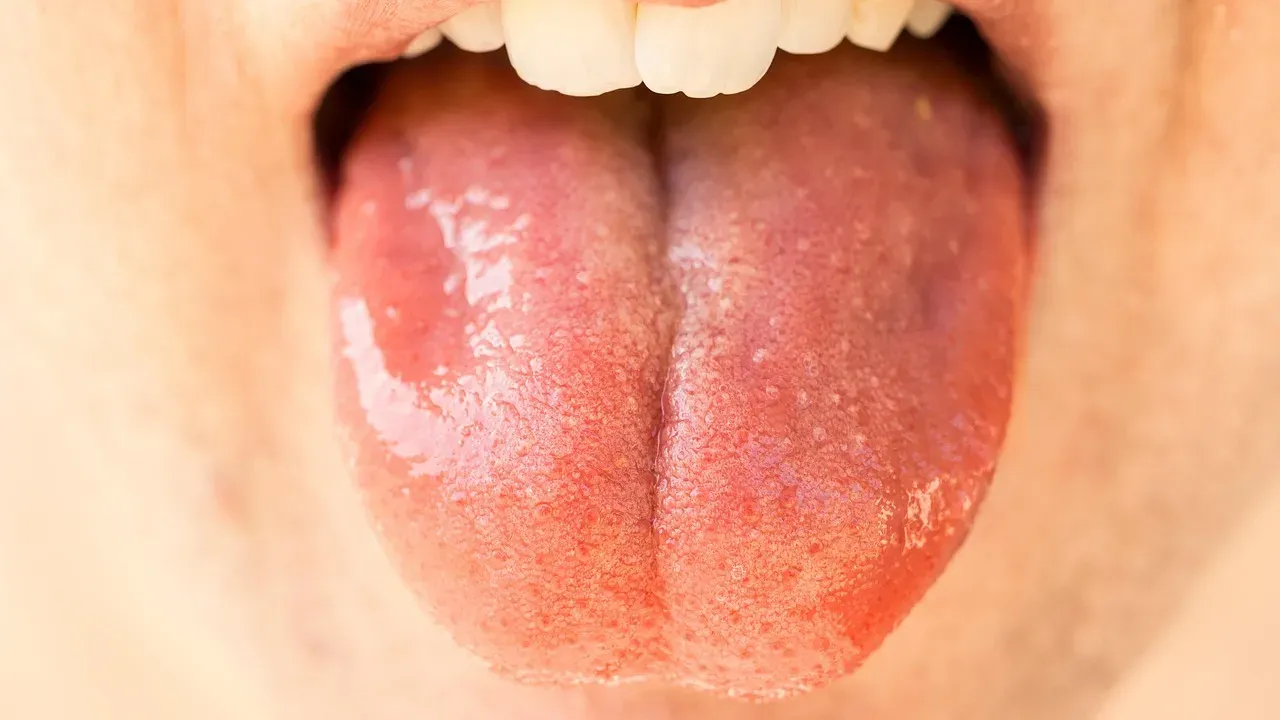 Your Taste Buds Aren't Like Everyone Else's (Image Credits: Pixabay)