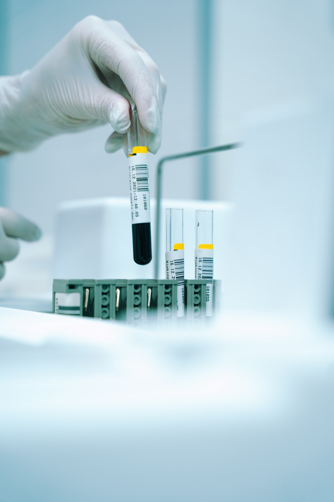 Your Blood Work Is Sending Warning Signals (image credits: unsplash)