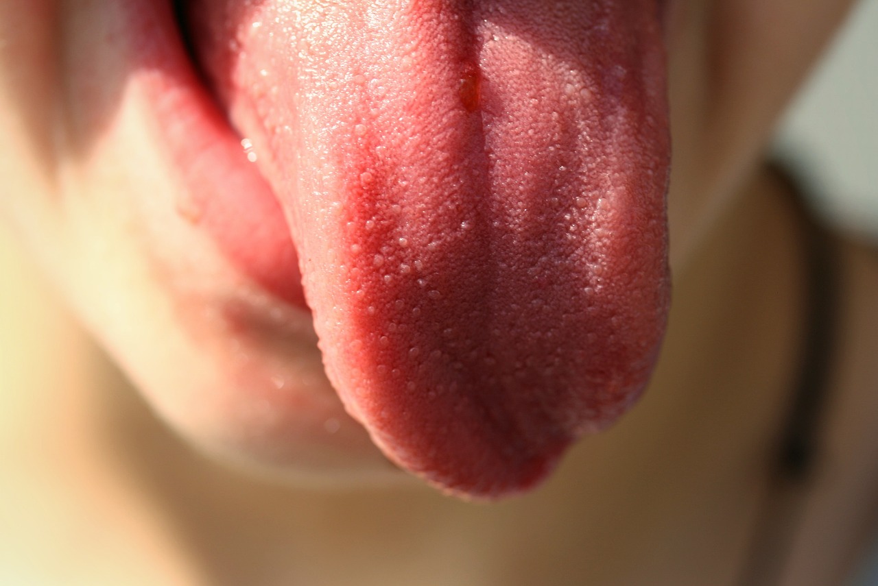 Glossy, Sore, or Swollen Tongue (image credits: pixabay)