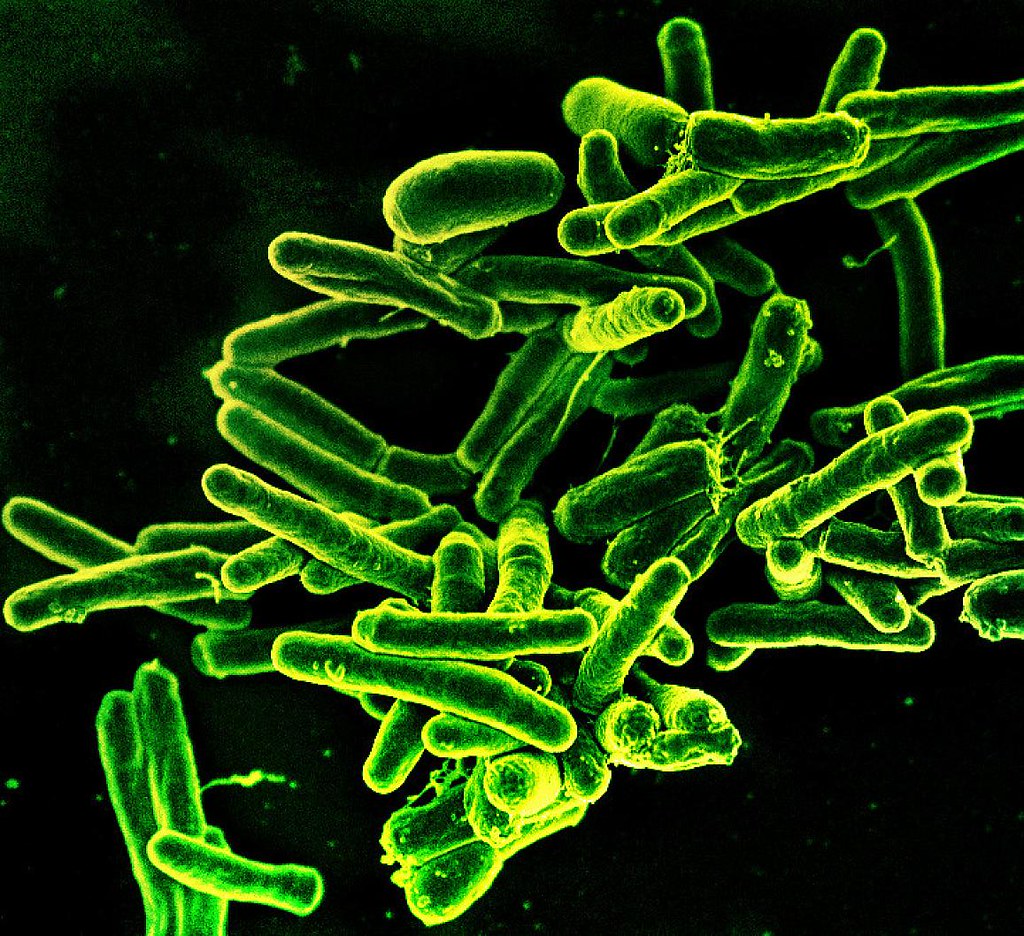 You're Believing The Frozen Food Kills Bacteria Myth (image credits: flickr)