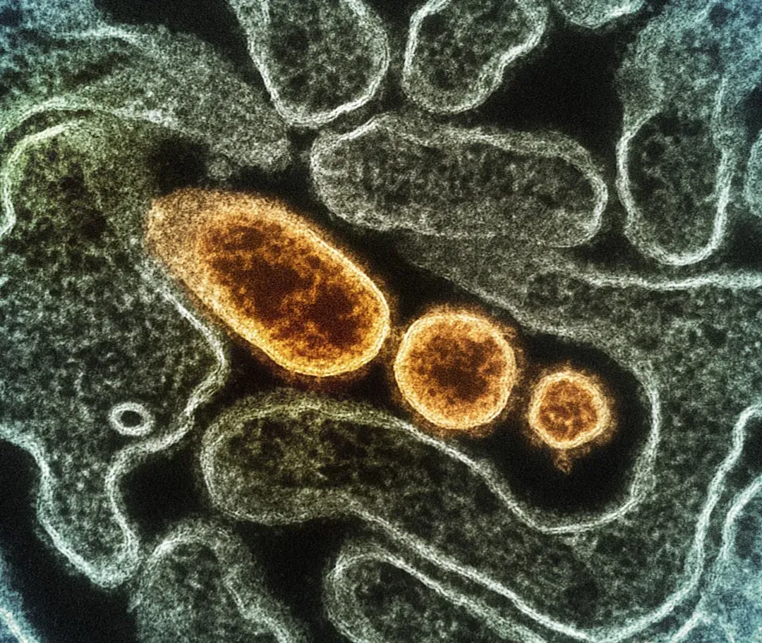 3. Mitochondrial Dysfunction at the Cellular Level (Image Credits: Unsplash)