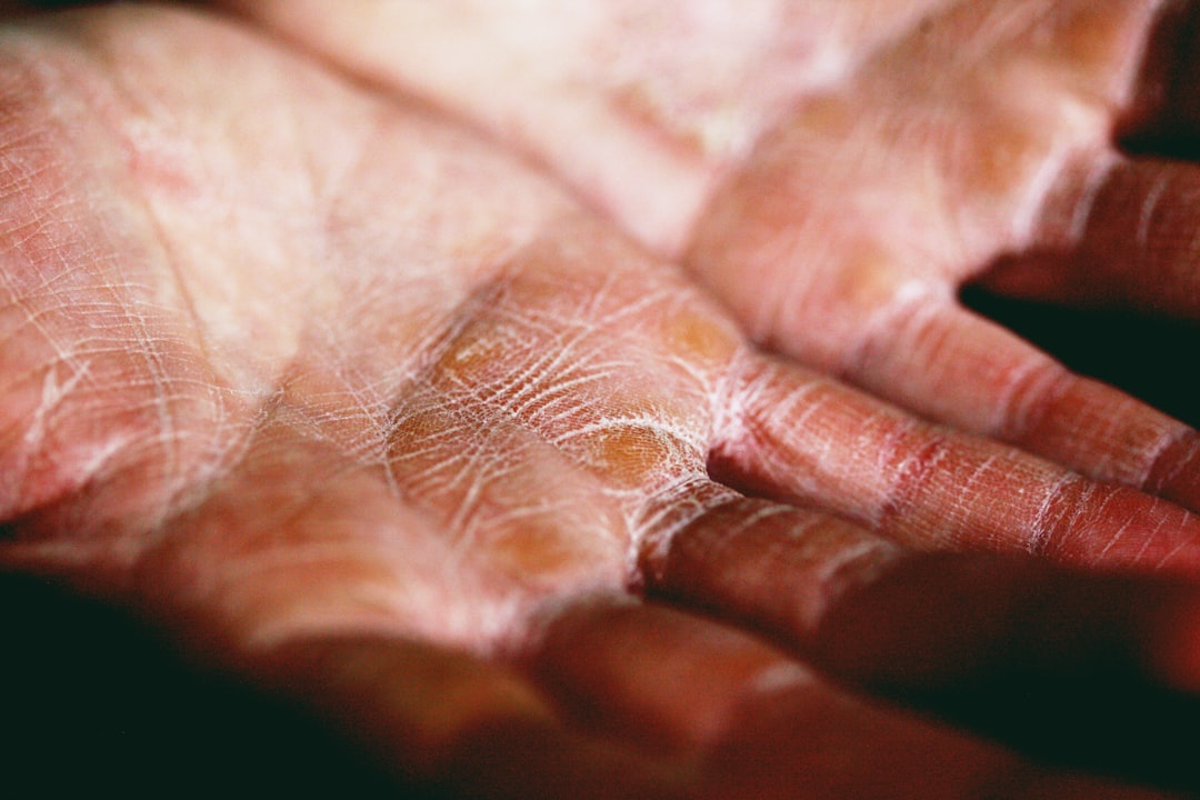 3. Brittle, Peeling Nails and Dry Skin (image credits: unsplash)