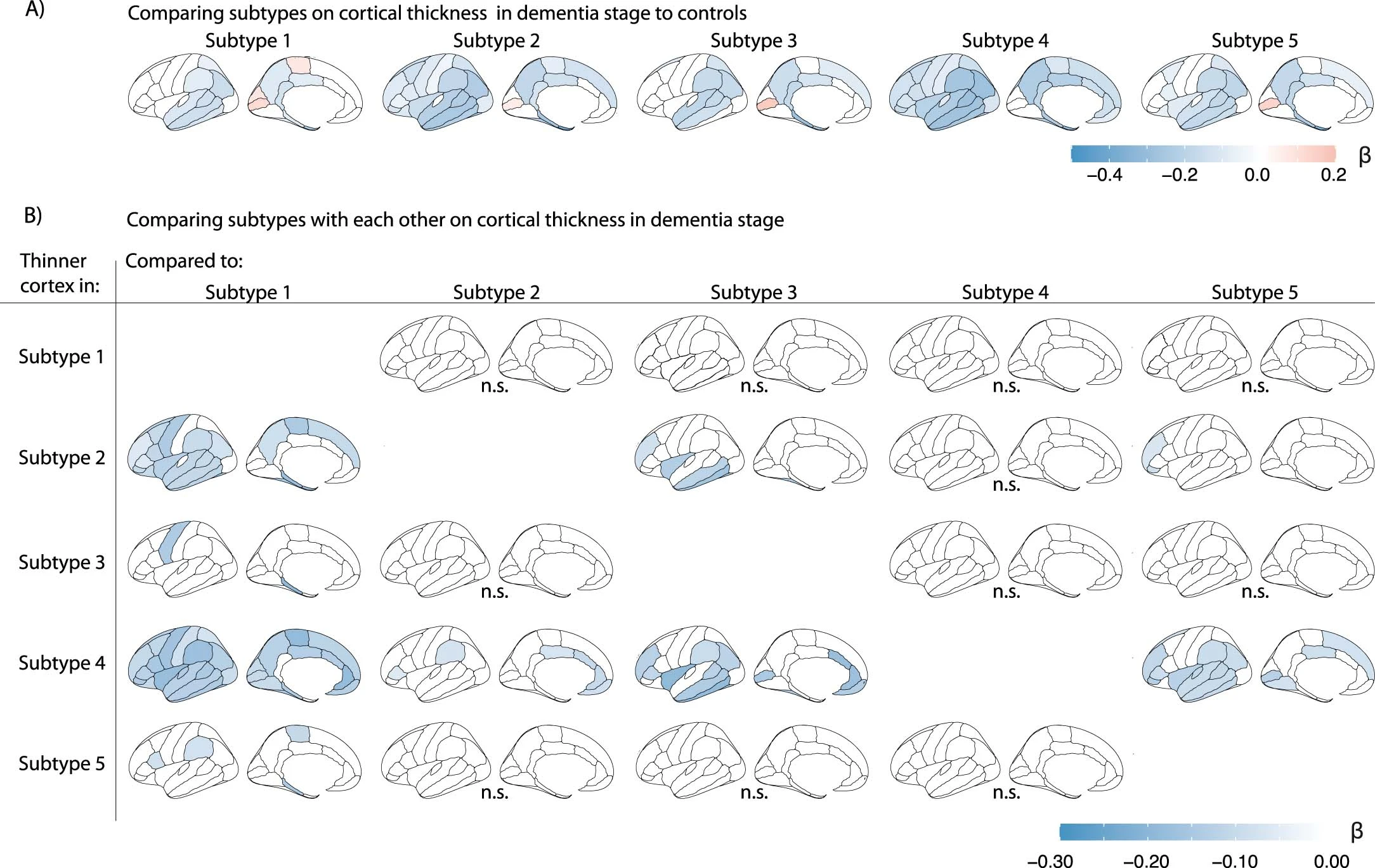 The Three Stages of Alzheimer’s Disease (image credits: wikimedia)
