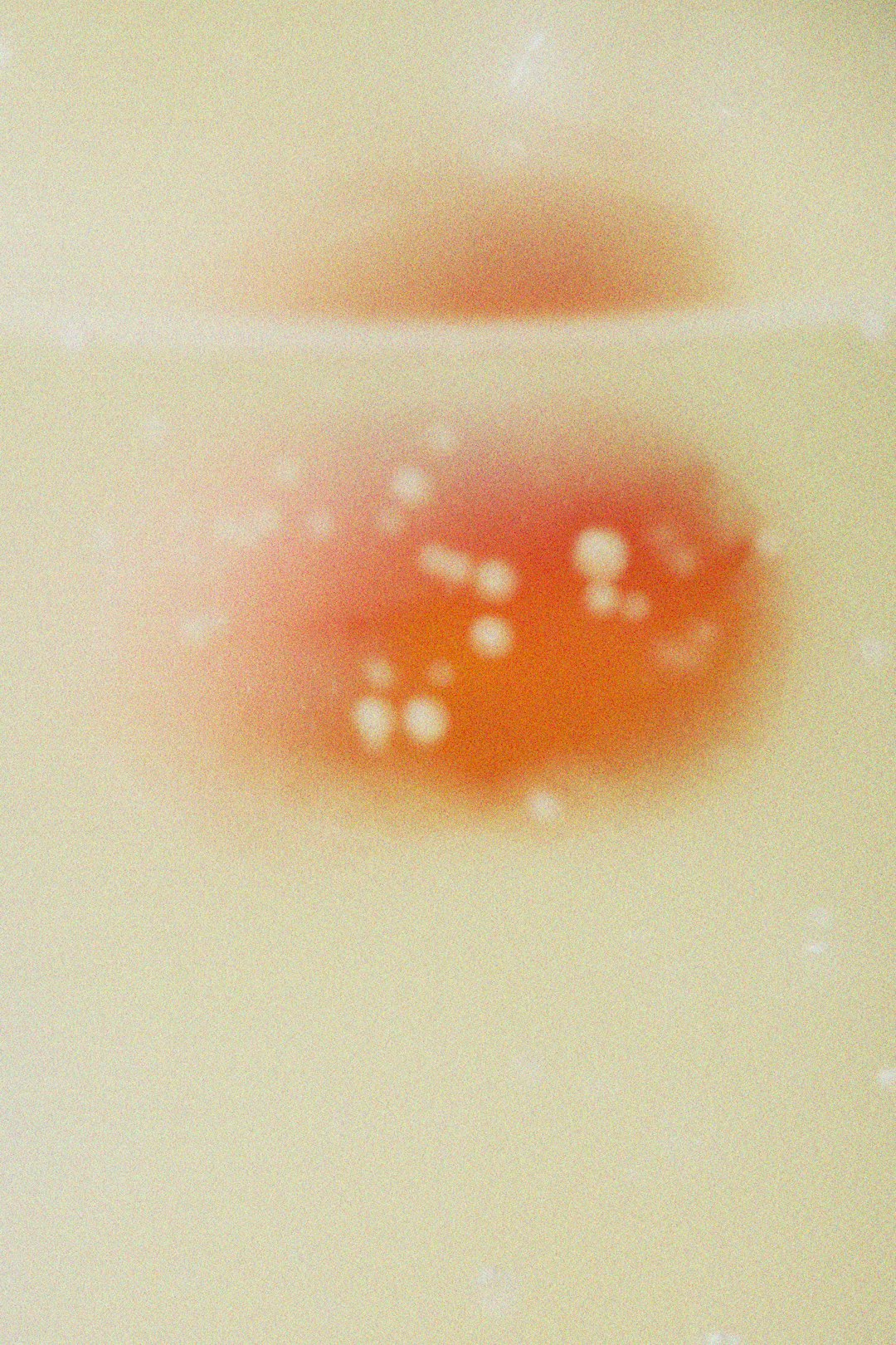 5. Pale or Yellow-Tinted Skin (image credits: unsplash)