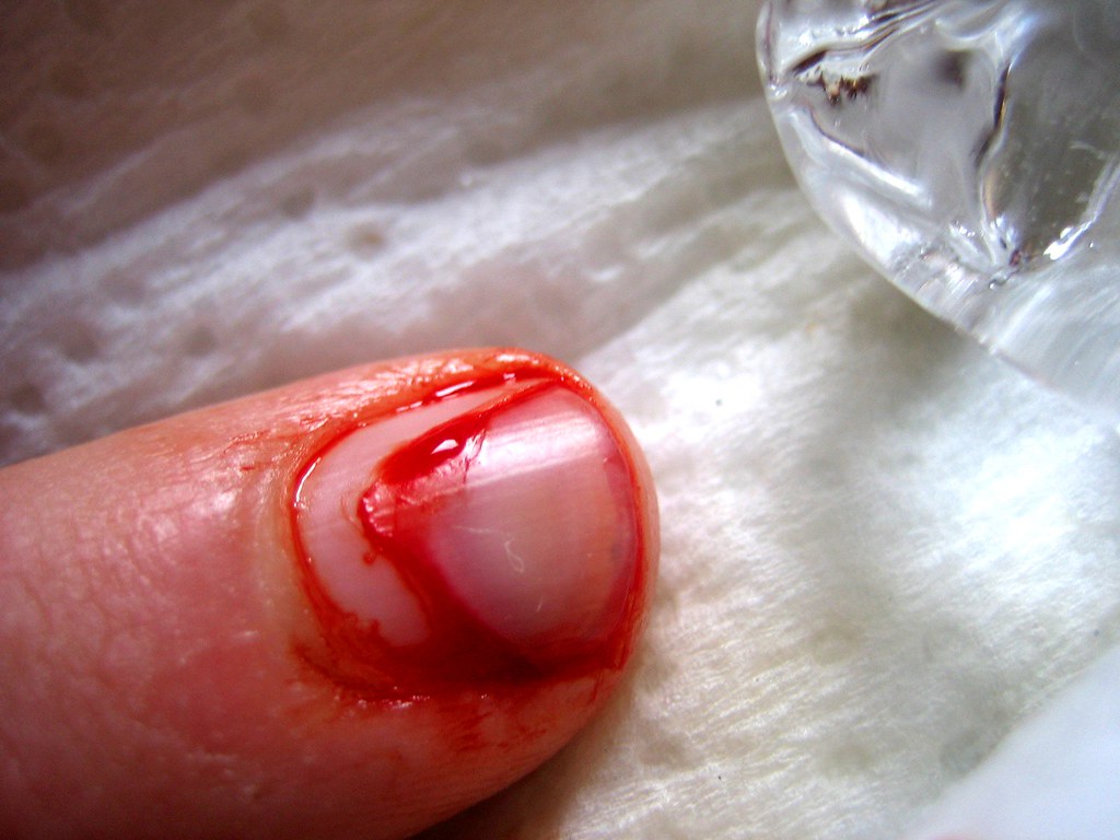 The Shocking Statistics Behind Kitchen Catastrophes (image credits: flickr)