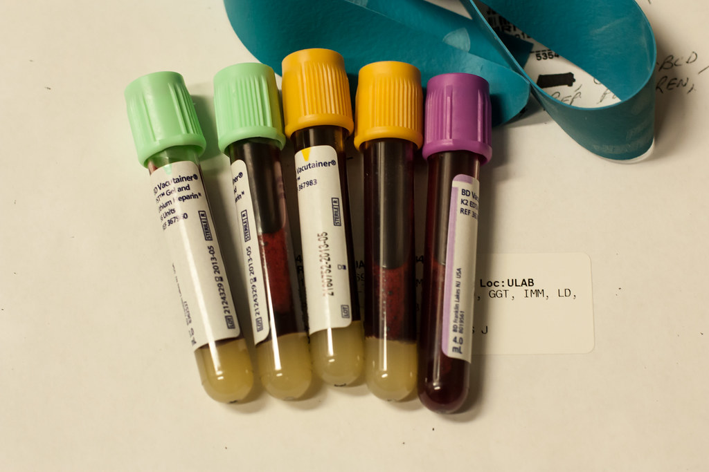 Why Standard Blood Tests Miss the Problem (image credits: flickr)