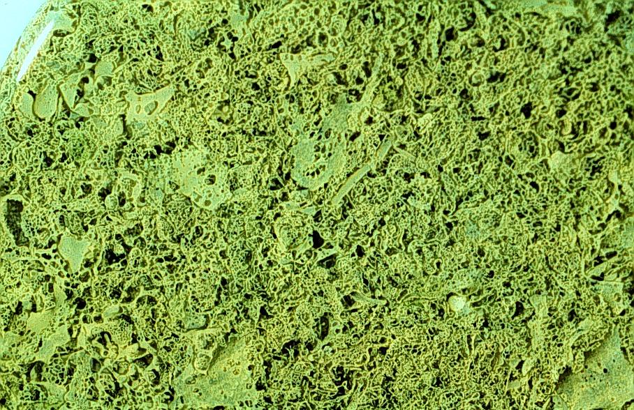 Spirulina: The Blue-Green Algae Contamination Risk (image credits: flickr)