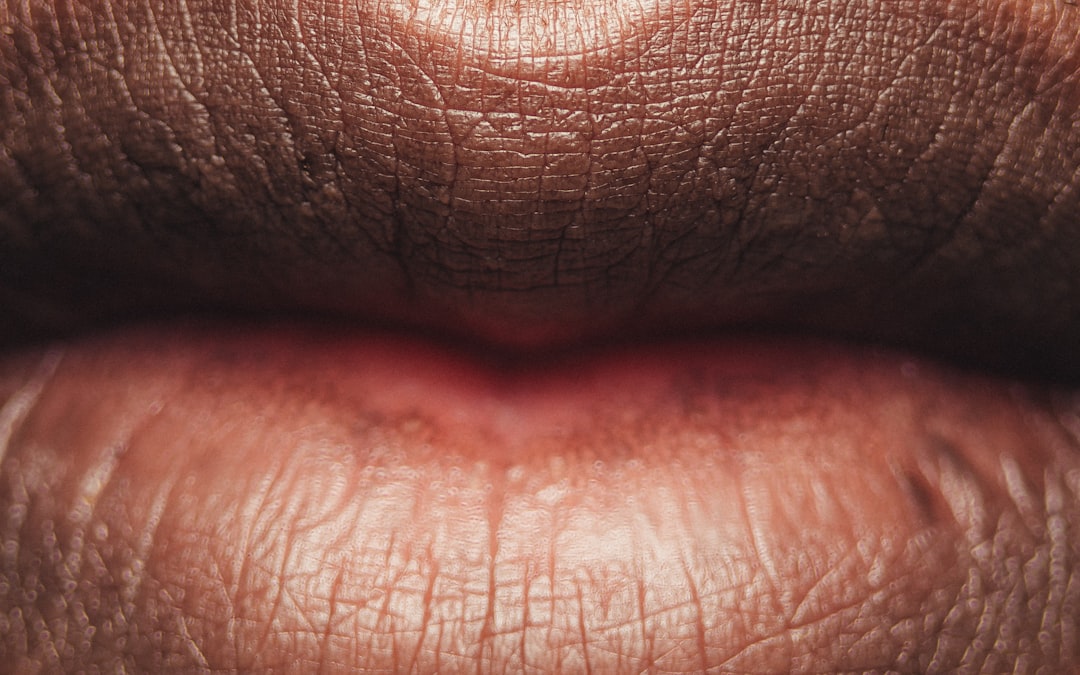 5. Cracking at the Corners of Your Mouth: Iron or Zinc Shortage (image credits: unsplash)