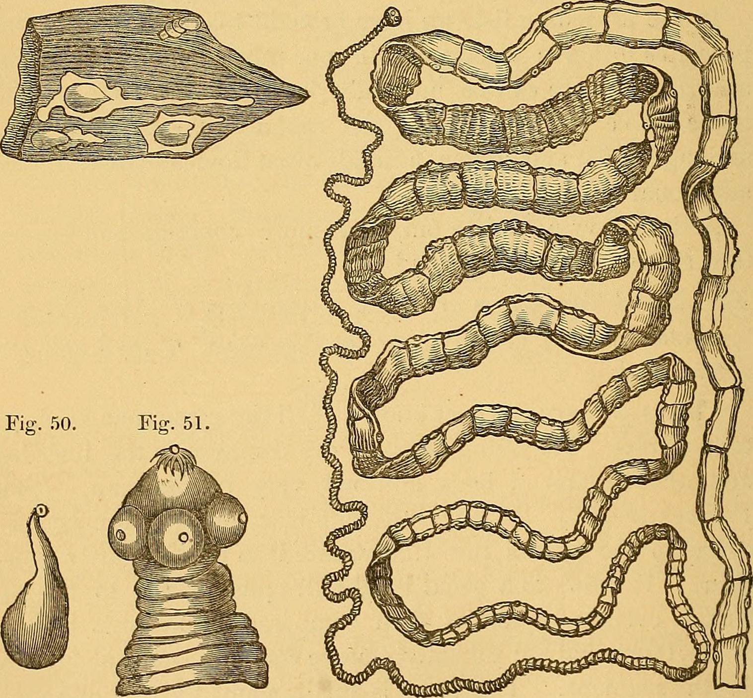 The Terrifying Reality of Tapeworm Dieting (image credits: wikimedia)