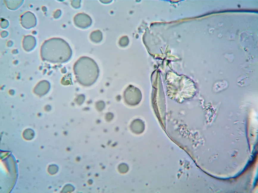 Protozoa: The Microscopic Regulators of Aquatic Life (Image Credits: Pexels)