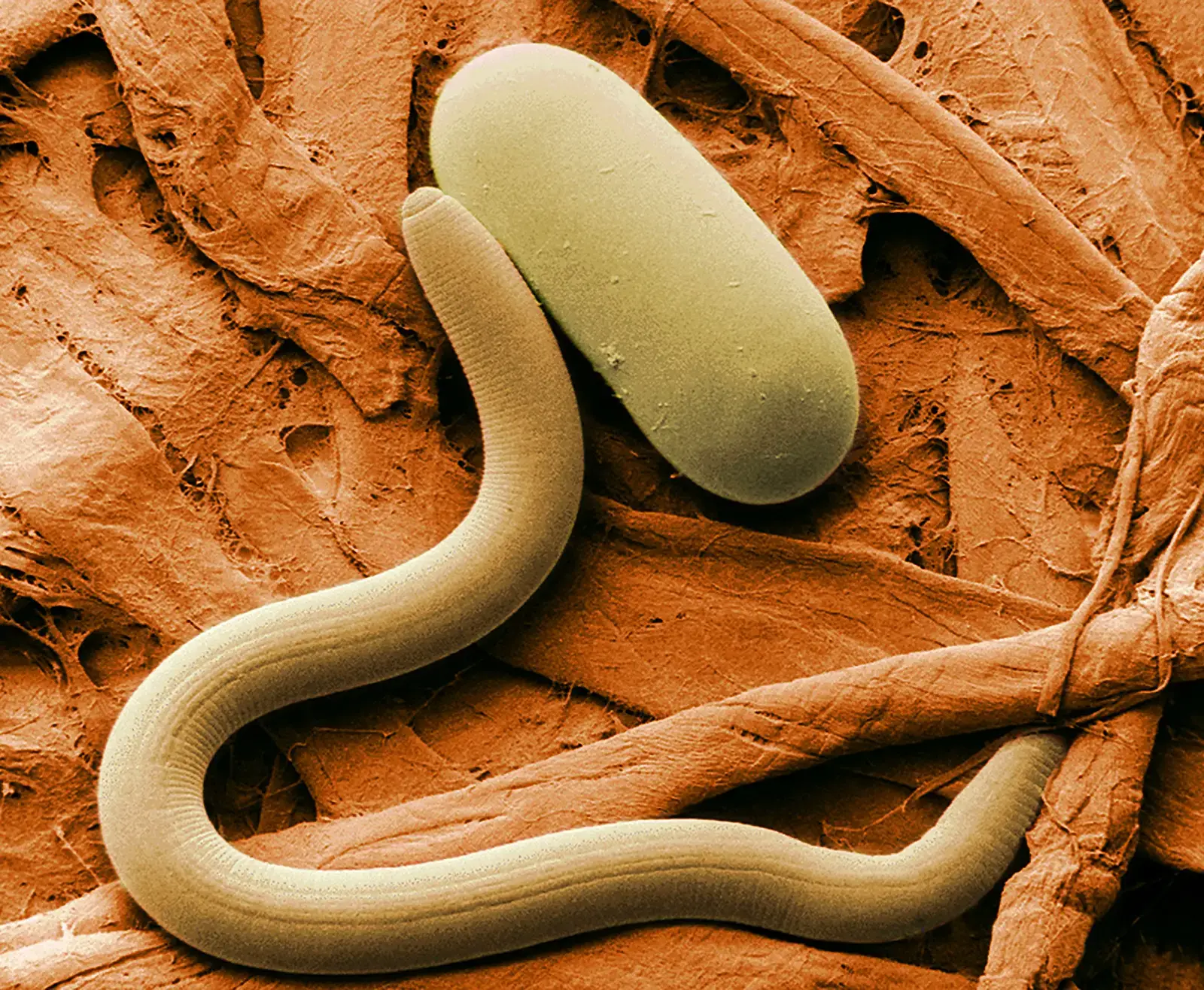10. The Freeze-Tolerant Nematode: Worms Revived After Thousands of Years (Image Credits: Wikimedia)