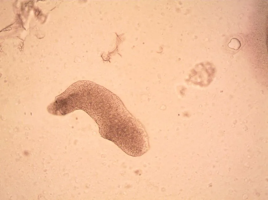 Conclusion: What These Creatures Really Tell Us About Life and Death (Image Credits: Pexels)