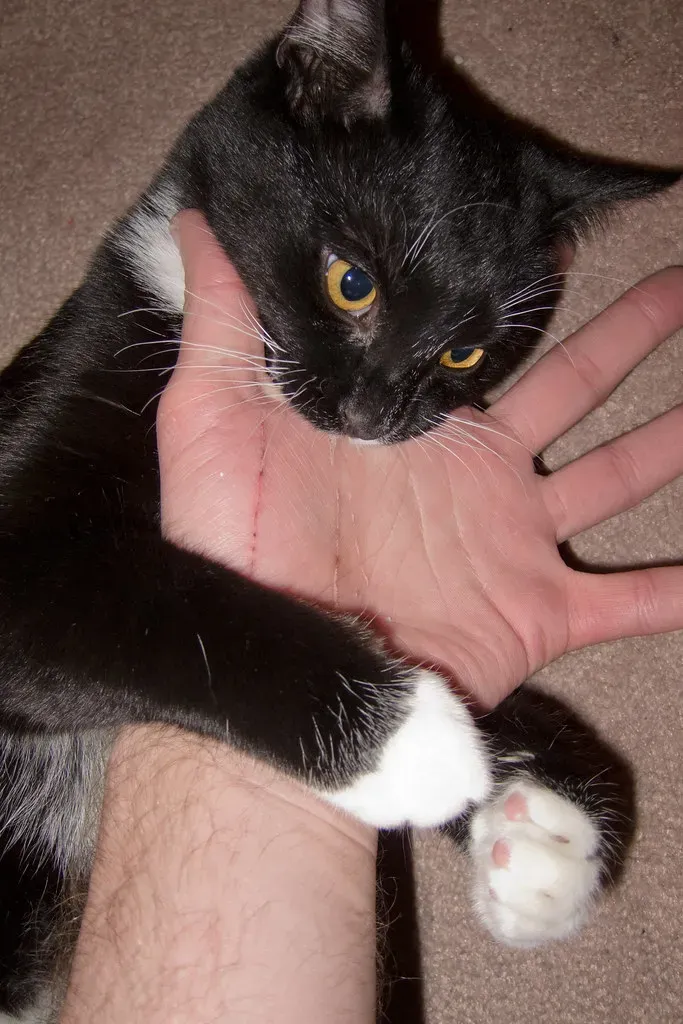 The Infection Rate Is Alarmingly High (Image Credits: Flickr)
