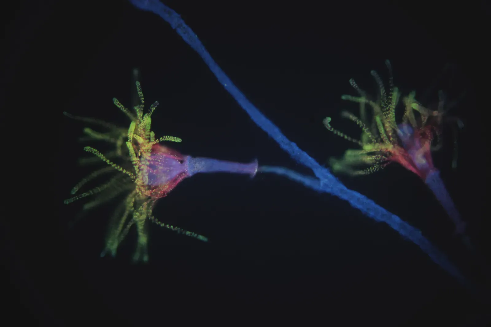 Freshwater Hydra (Image Credits: Wikimedia)