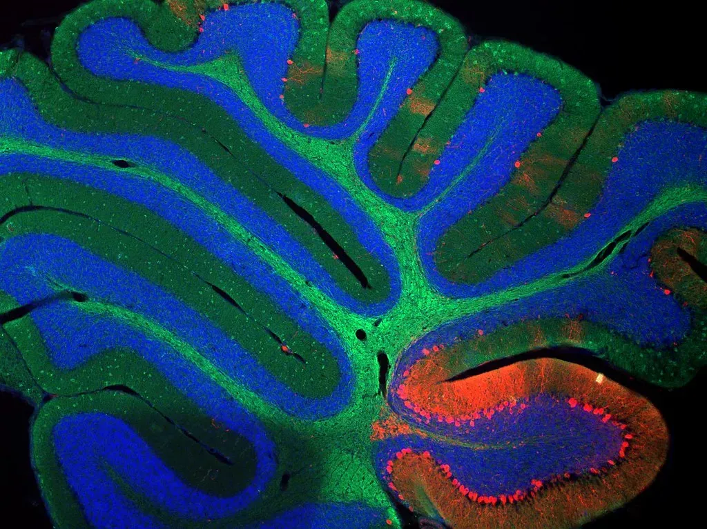 A Final Thought (NICHD NIH, Flickr, CC BY 2.0)