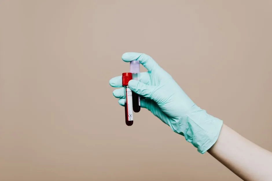#5 - Bloodwork Isn't "Extra"; It's the Early-Warning System (Image Credits: Pexels)