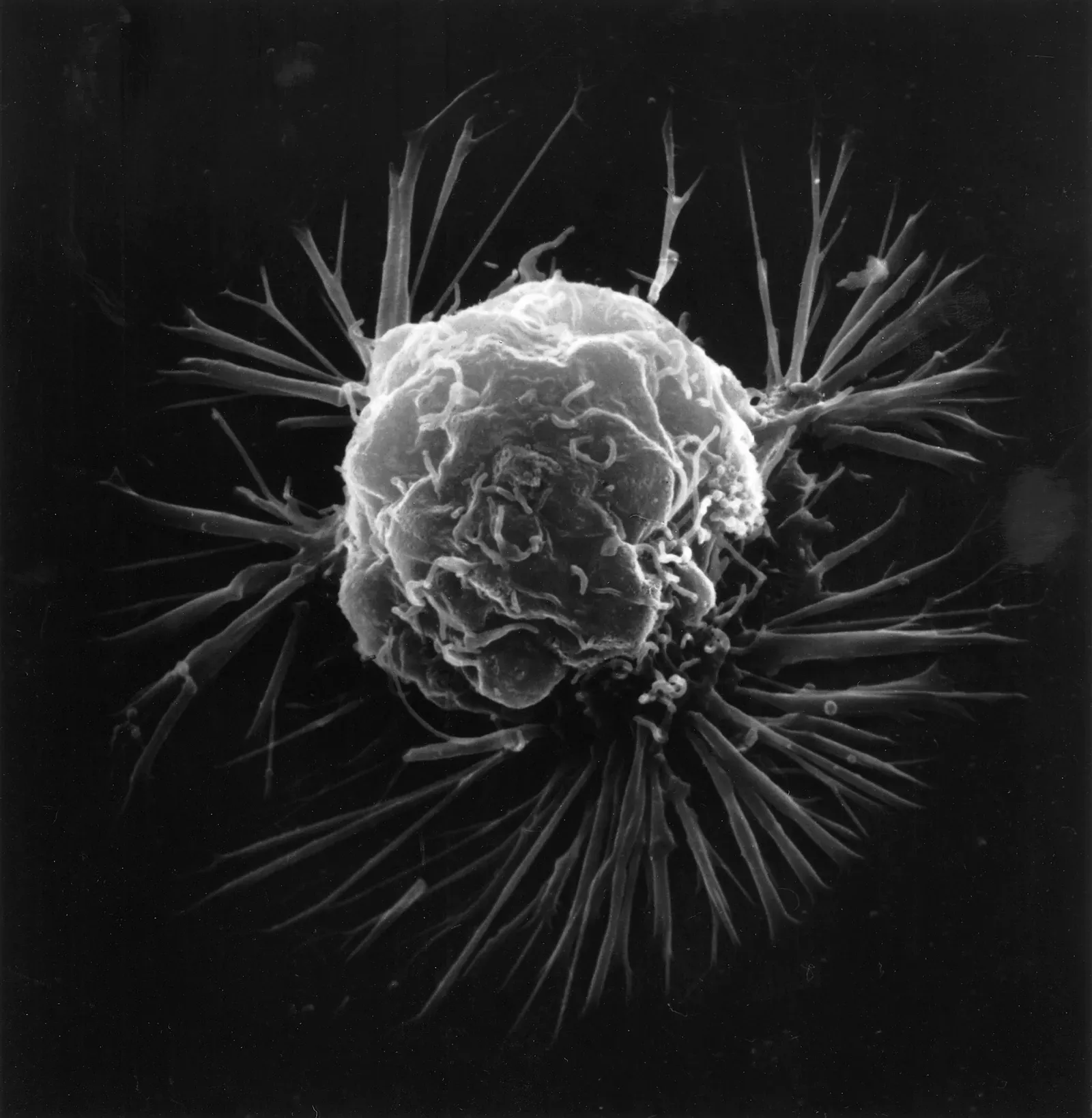 Growth Peptides Can Fuel Hidden Cancers (Image Credits: Wikimedia)