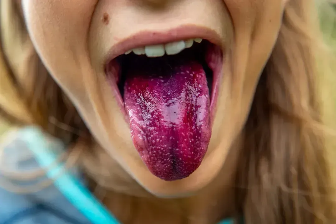 Fruit Roll-Ups (Image Credits: Unsplash)