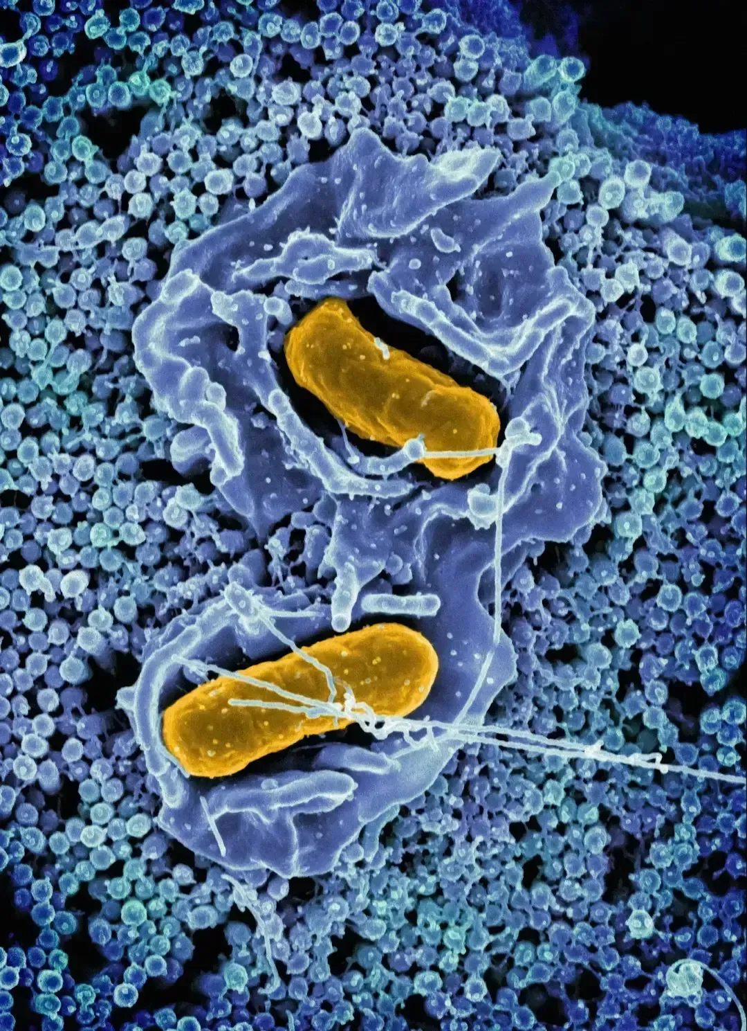 Bacteria Causing Ulcers: The Germ Nobody Believed In (Image Credits: Unsplash)